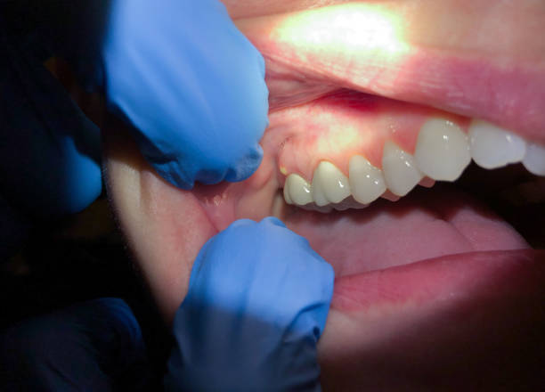 Best Walk-In Emergency Dentist in West Jefferson, NC